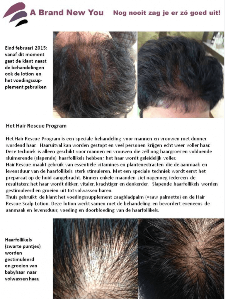 Hair Rescue Program Overzicht foto's, informatie en uitleg