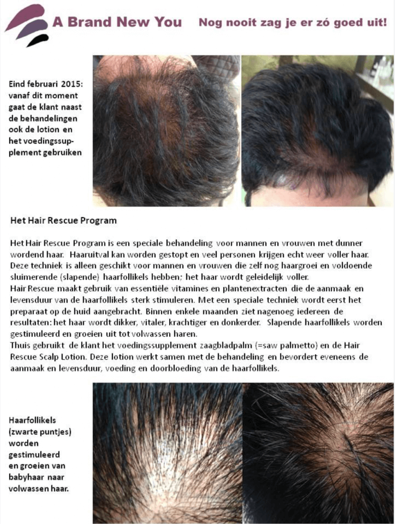 Hair Rescue Program Overzicht foto's, informatie en uitleg