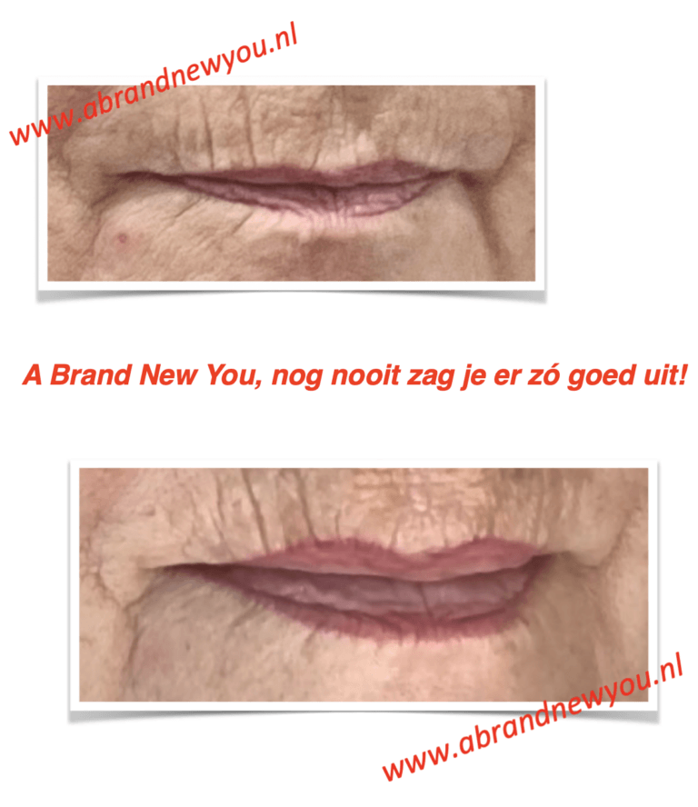 Marjolein Liplijn en shade